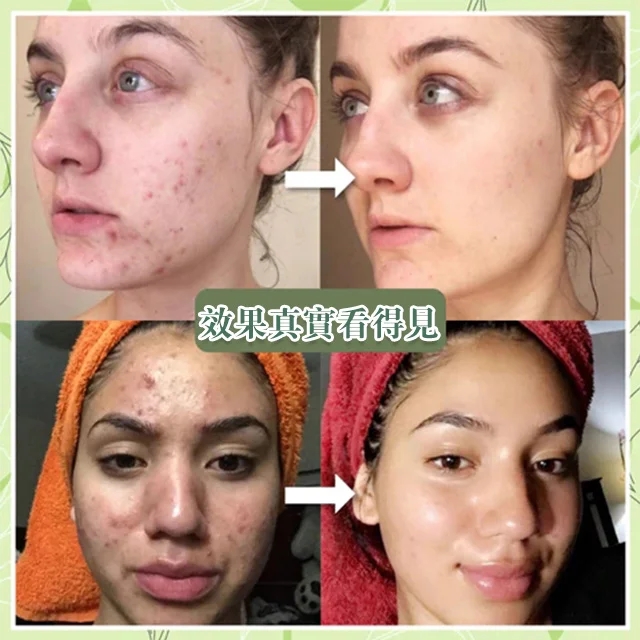 綠茶保濕清潔泥膜，告別油膩臟臟臉，挑戰去污後不拔幹